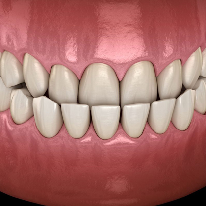 Digital illustration of healthy aligned teeth and pink gums showing proper dental development.