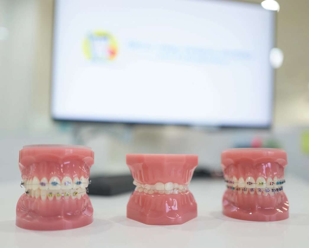 Three dental models with braces displayed on table in orthodontic office setting.